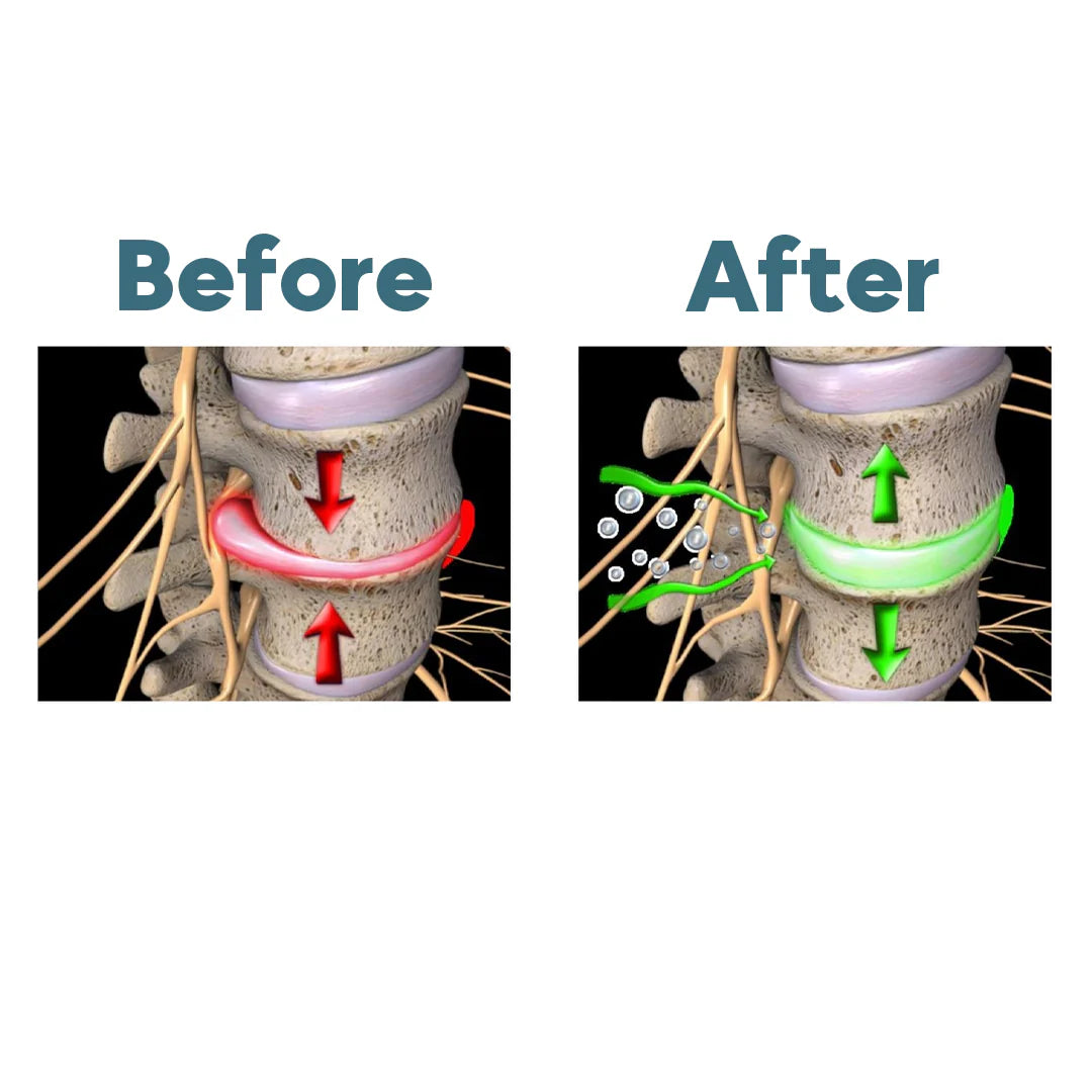 Noorven TripleComfort